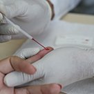 #12513 Campus ofertará teste para Sífilis e HIV